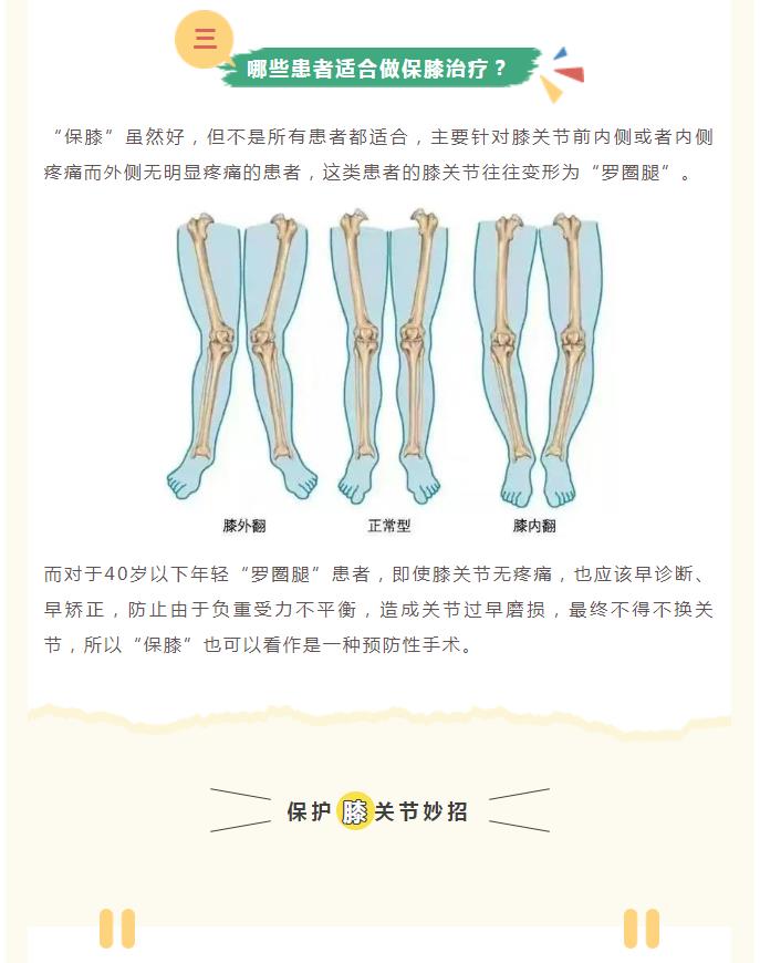 【5.27我爱膝】全国保膝日，与您膝膝相关！