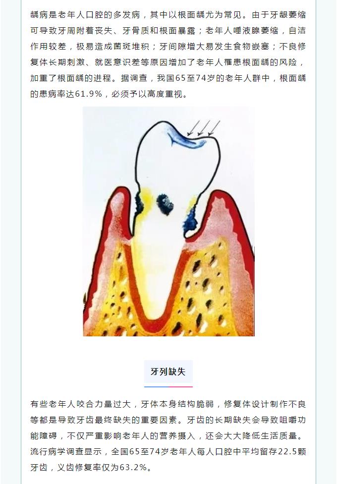 义诊预告 | 身体健康，从“齿”开始