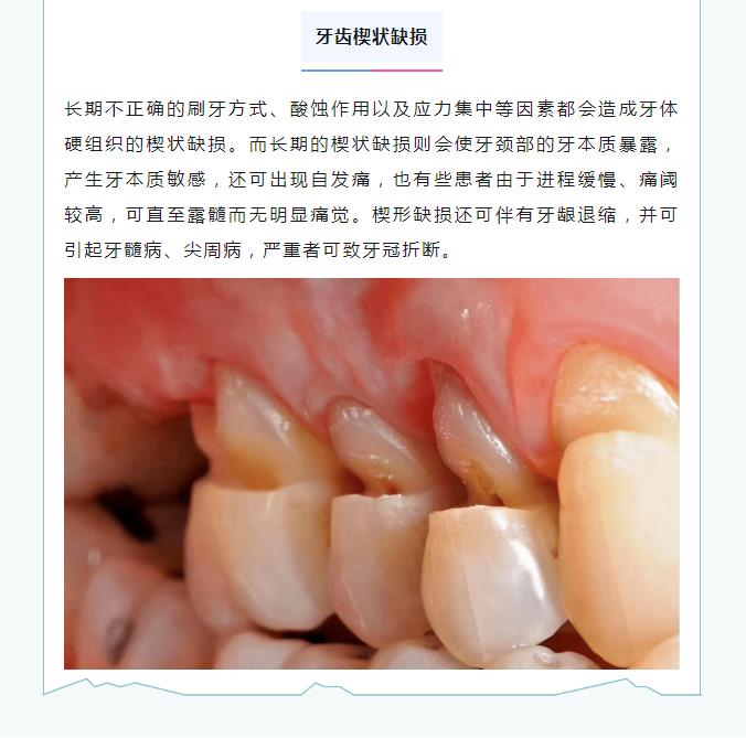 义诊预告 | 身体健康，从“齿”开始