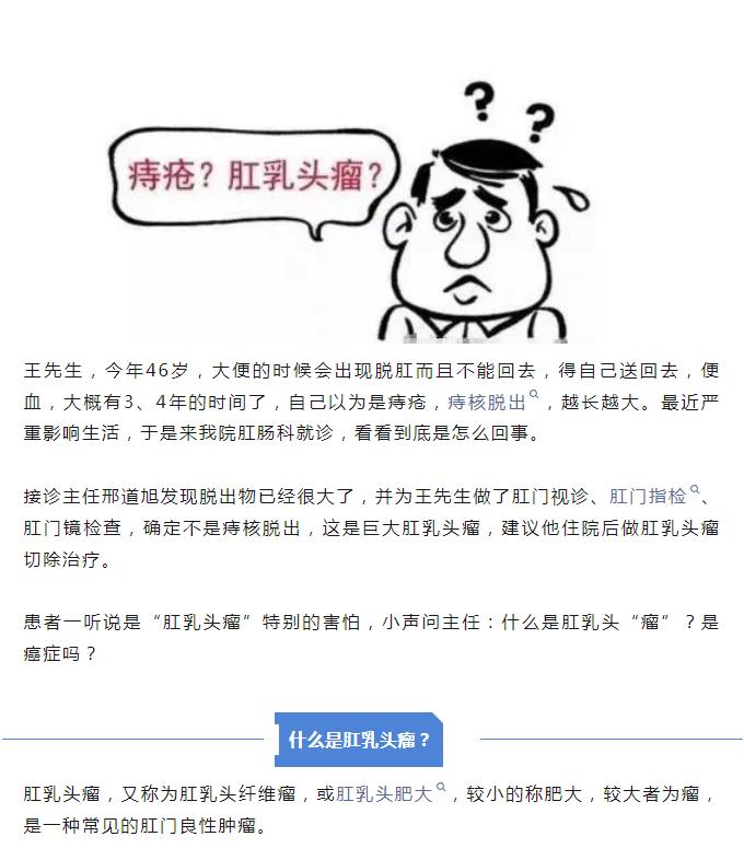 案例警示：千万不要把“肛乳头瘤”当痔疮