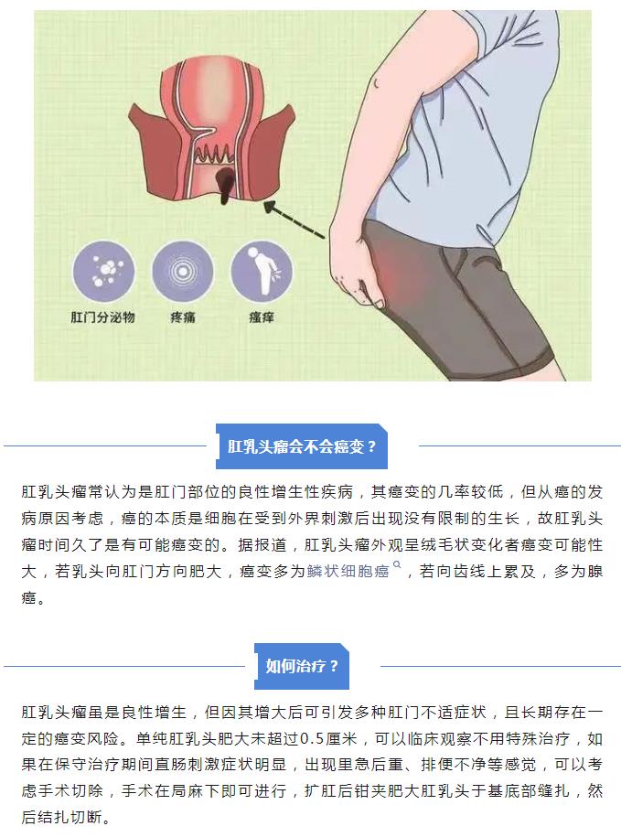 案例警示：千万不要把“肛乳头瘤”当痔疮