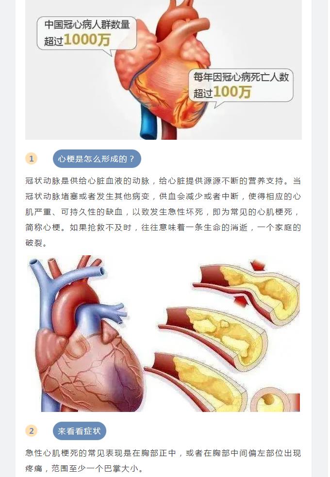 中国心梗救治日 | 珍惜生命 从心开始